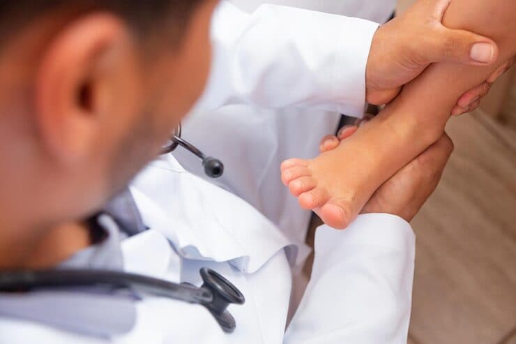 Clubfoot Correction (Ponseti Method) & Paediatric Deformity